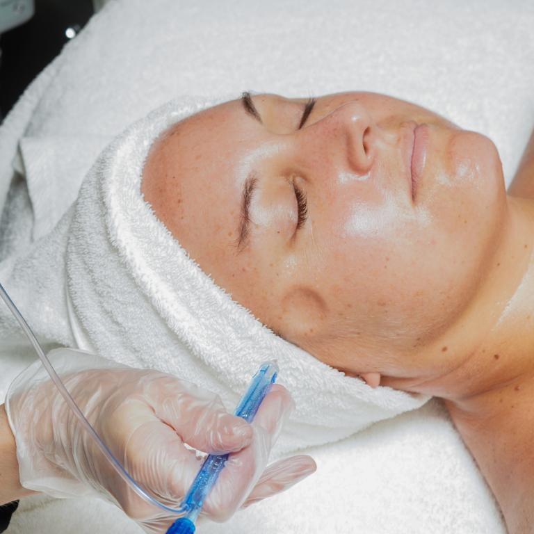 Woman receiving jetpeel facial